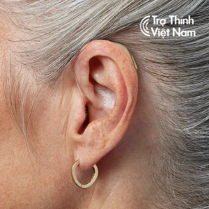 Máy trợ thính loa trong Bernafon Encanta miniRITE - Hình ảnh 6